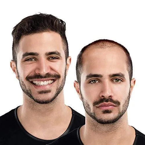 Hair Patch Transformation