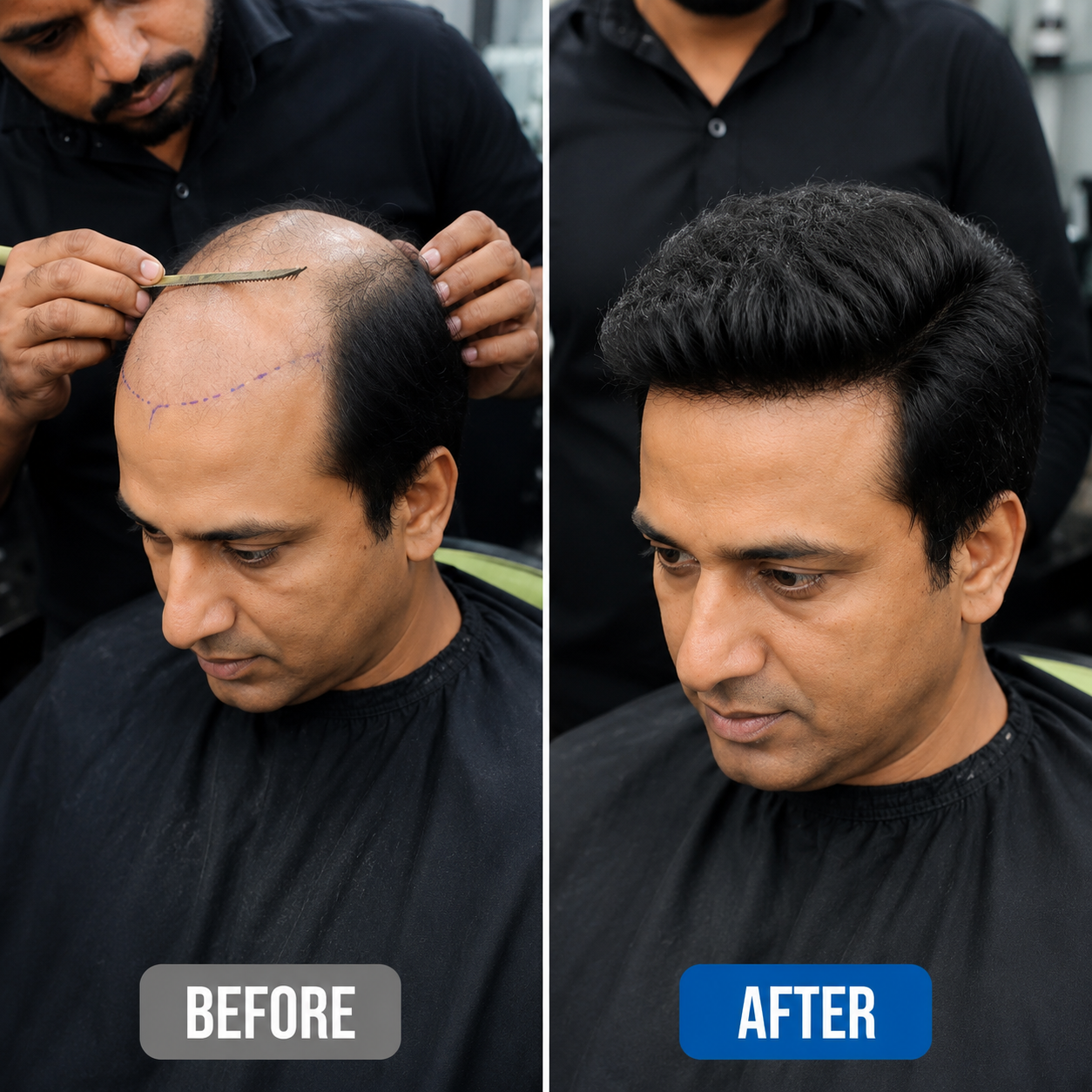 Hair Weaving Result